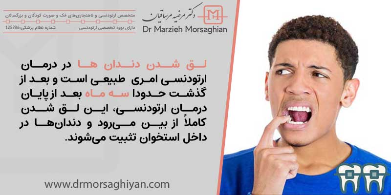 آیا ارتودنسی باعث لق شدن دندان می‌شود؟