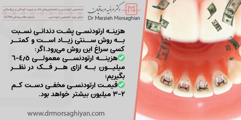 قیمت ارتودنسی لینگوال در تهران