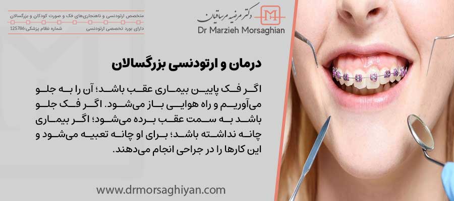 رمان و ارتودنسی بزرگسالان توسط دکتر مرضیه مرساقیان متخصص ارتودنسی در تهران