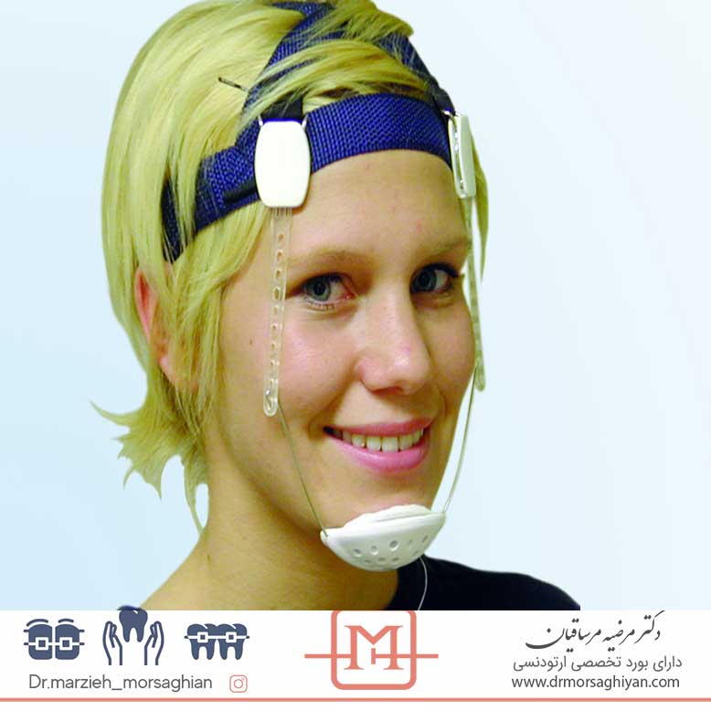 درمان و اصلاح فک با ارتودنسی بدون جراحی | دکتر مرضیه مرساقیان متخصص ارتودنسی در تهران