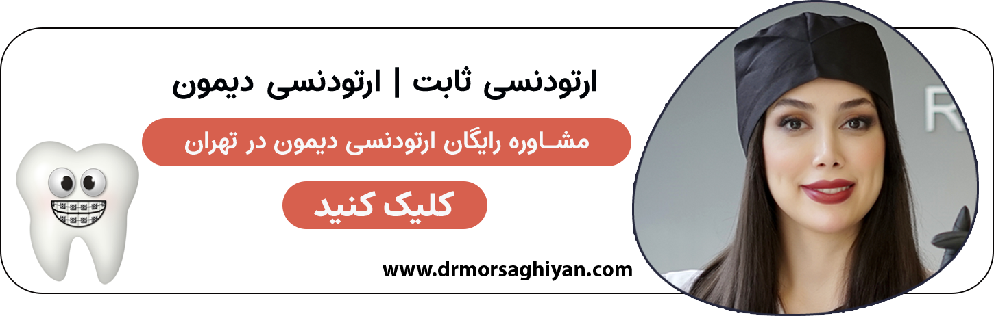 مشاوره رایگان ارتودنسی دیمون در شمال تهران | دکتر مرضیه مرساقیان
