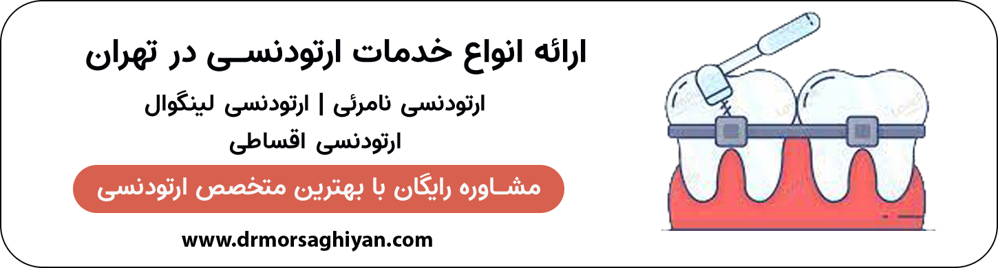 ارائه انواع خدمات ارتودنسی در الهیه تهران | دکتر مرضیه مرساقیان