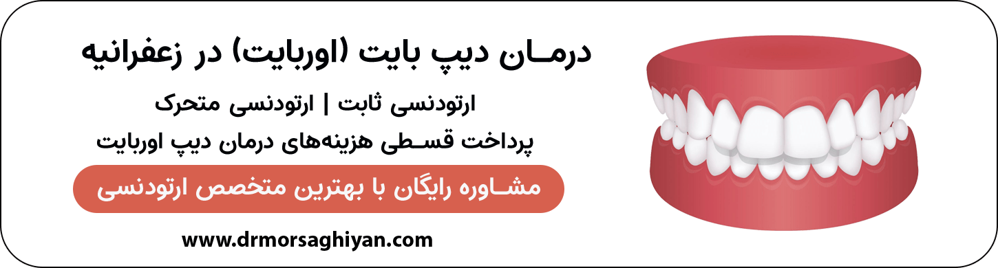 ارائه انواع خدمات درمانی دیپ بایت (اوربایت) در زعفرانیه تهران | دکتر مرضیه مرساقیان