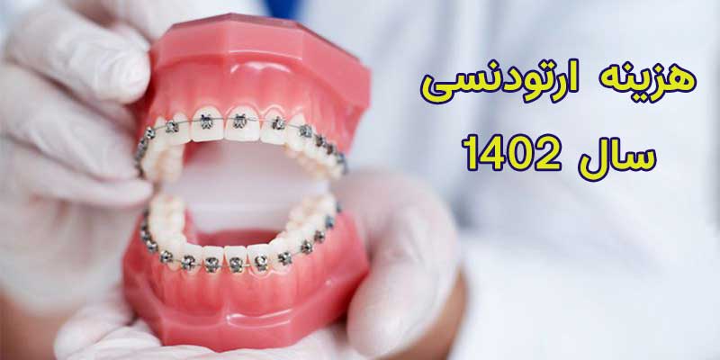 هزینه و قیمت ارتودنسی دندان سال 1402 در تهران